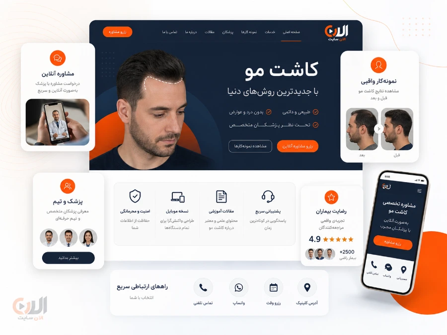 نمونه کارها در سایت کاشت مو